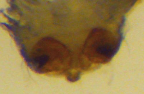 Agyneta simplicitarsis