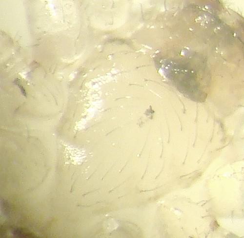Platnickina nigropunctata