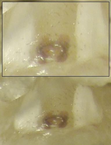 Platnickina nigropunctata