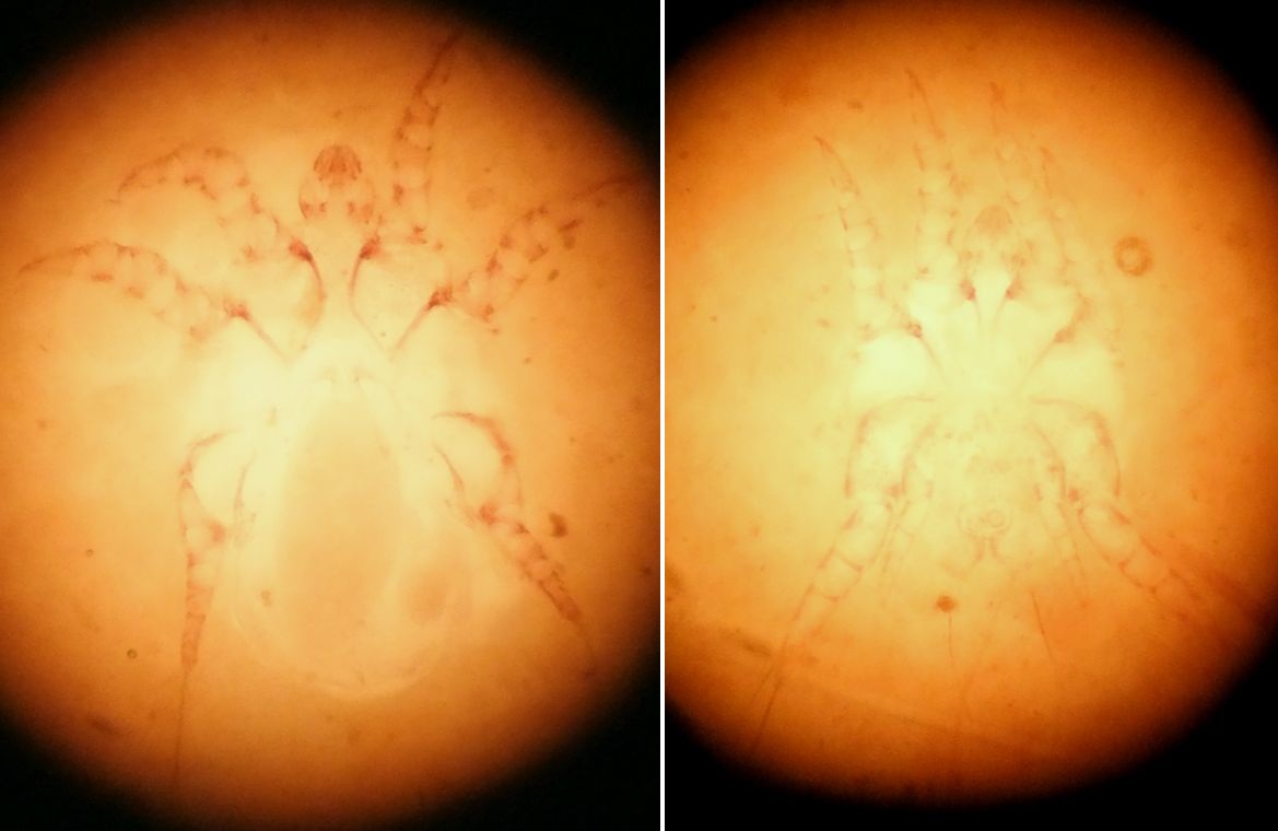 Vincent VALLI - Otodectes cynotis - réf. 97944 (1169 x 760 pixels, 107 ko)